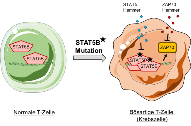 Grafische Darstellung einer Normalen T-Zelle und einer bösartigen T-Zelle