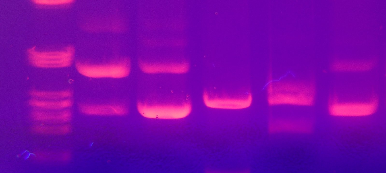Foto von DNA-Banden nach Gel-Elektrophorese