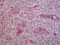 HE-gef&auml;rbter Schnitt