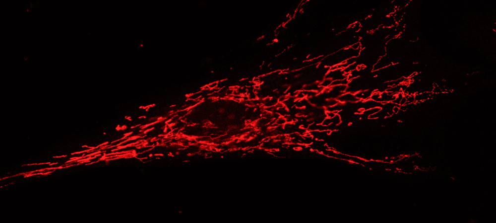 Fibroblast with stained mitochondria, Photo: Karin Nowikovsky/Vetmeduni