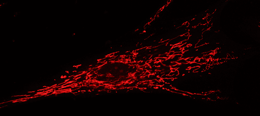 Fibroblast mit gefärbten Mitochondrien (rot), Foto: Karin Nowikovsky/Vetmeduni