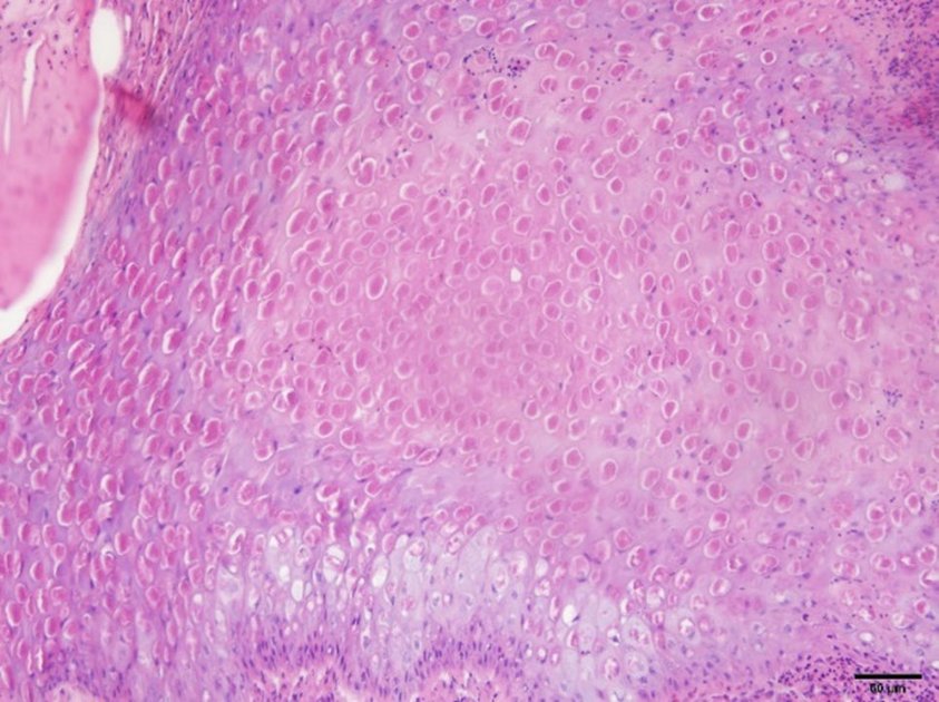 IV. Pars pro Toto: In der Geflügelmedizin werden einzelne Tiere pathologisch untersucht, um die Herdengesundheit zu erhalten oder wiederherzustellen. Im Bild Pathohistologische Untersuchung einer veränderten Hautstelle mit massenhaft „Bollinger‘schen Einschlusskörperchen“. Foto: Universitätsklinik für Geflügel/Vetmeduni Vienna
