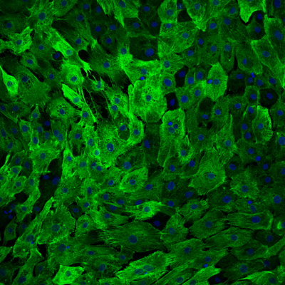 Confocal laser scanning microscopy of cultivated equine jejunum epithelium cells (cytokeratin green, nuclei blue