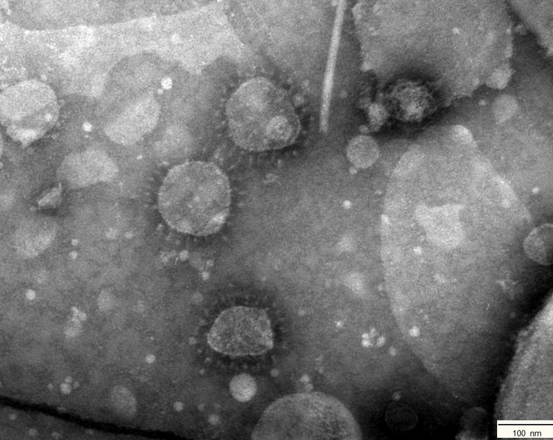 Vergrößert: Coronaviren im Elektronenmikroskop (Negativkontrastverfahren). Foto © Nora Dinhopl/Vetmeduni Vienna