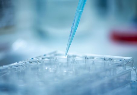 Pipettieren