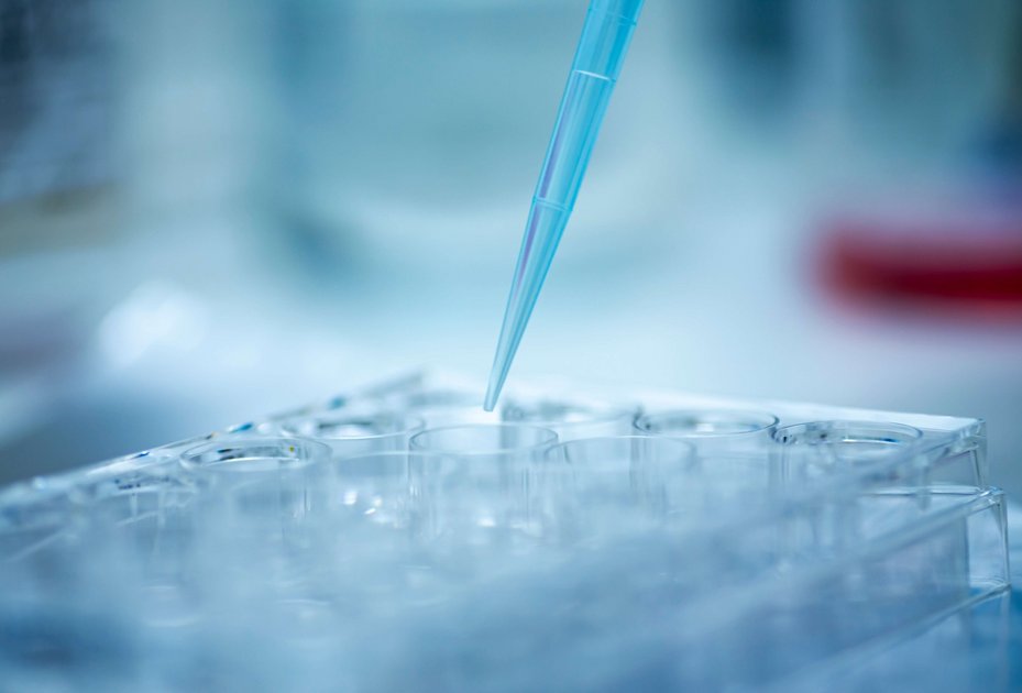 Pipettieren