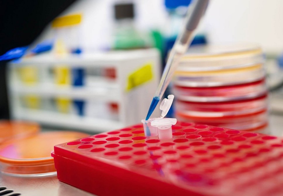 Pipette, Petrischalen und Laborutensilien
