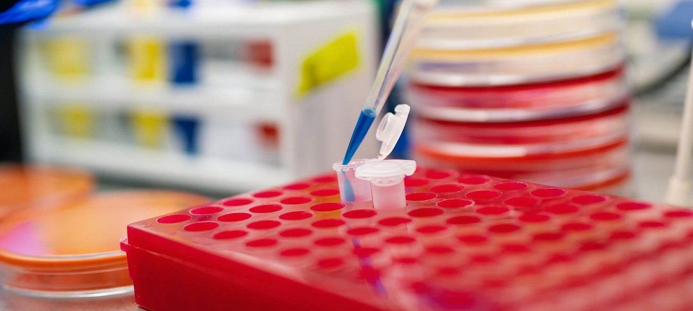 Pipette, Petrischalen und Laborutensilien