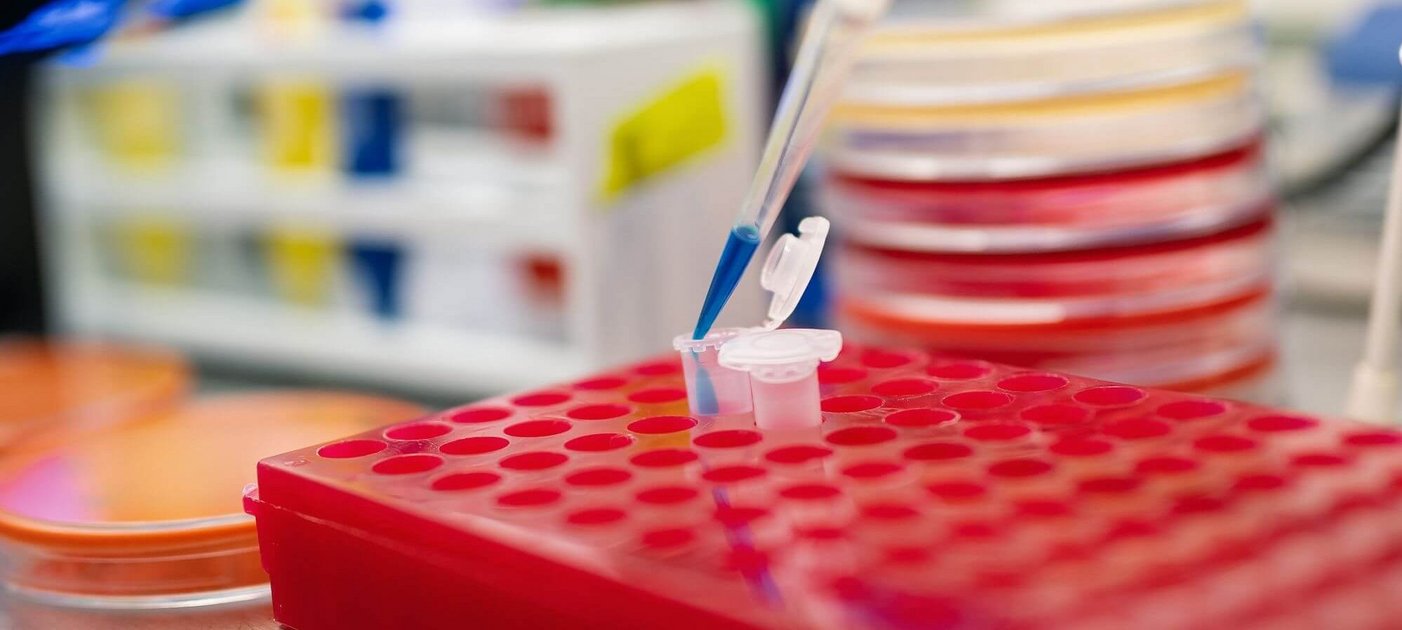 Pipette, Petrischalen und Laborutensilien