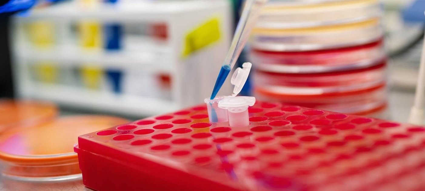 Pipette, Petrischalen und Laborutensilien