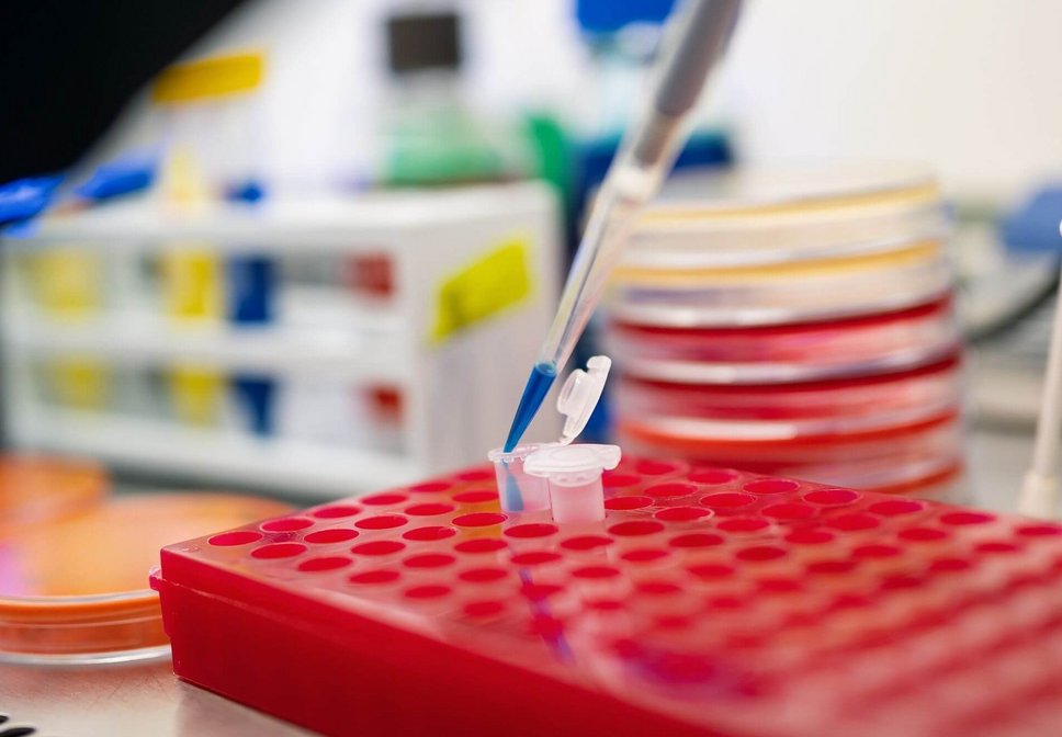 Pipette, Petrischalen und Laborutensilien