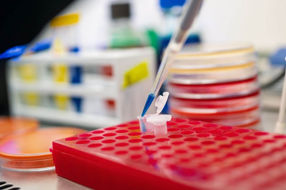 Pipette, Petrischalen und Laborutensilien