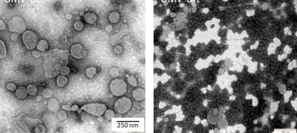 Elektronenmikroskopische Aufnahmen der äußeren Membranvesikel (OMVs). Foto: Institut für Virologie/Vetmeduni 