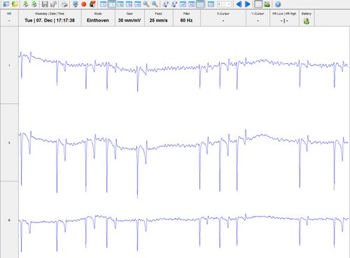 Vorhofflimmern (Foto: &copy; Vetmeduni Vienna)