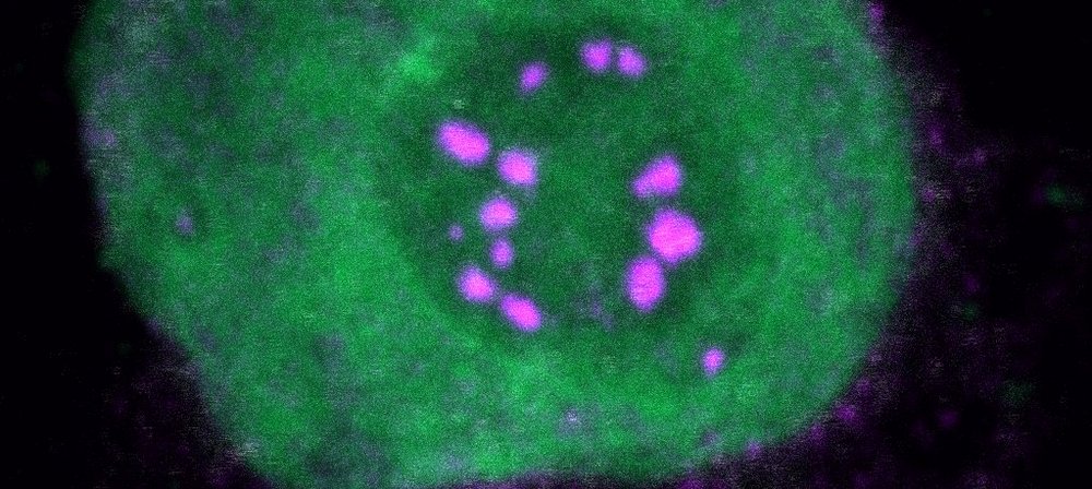 NUP98-Fusionsproteine, Foto: S. Terlecki-Zaniewicz/CCRI