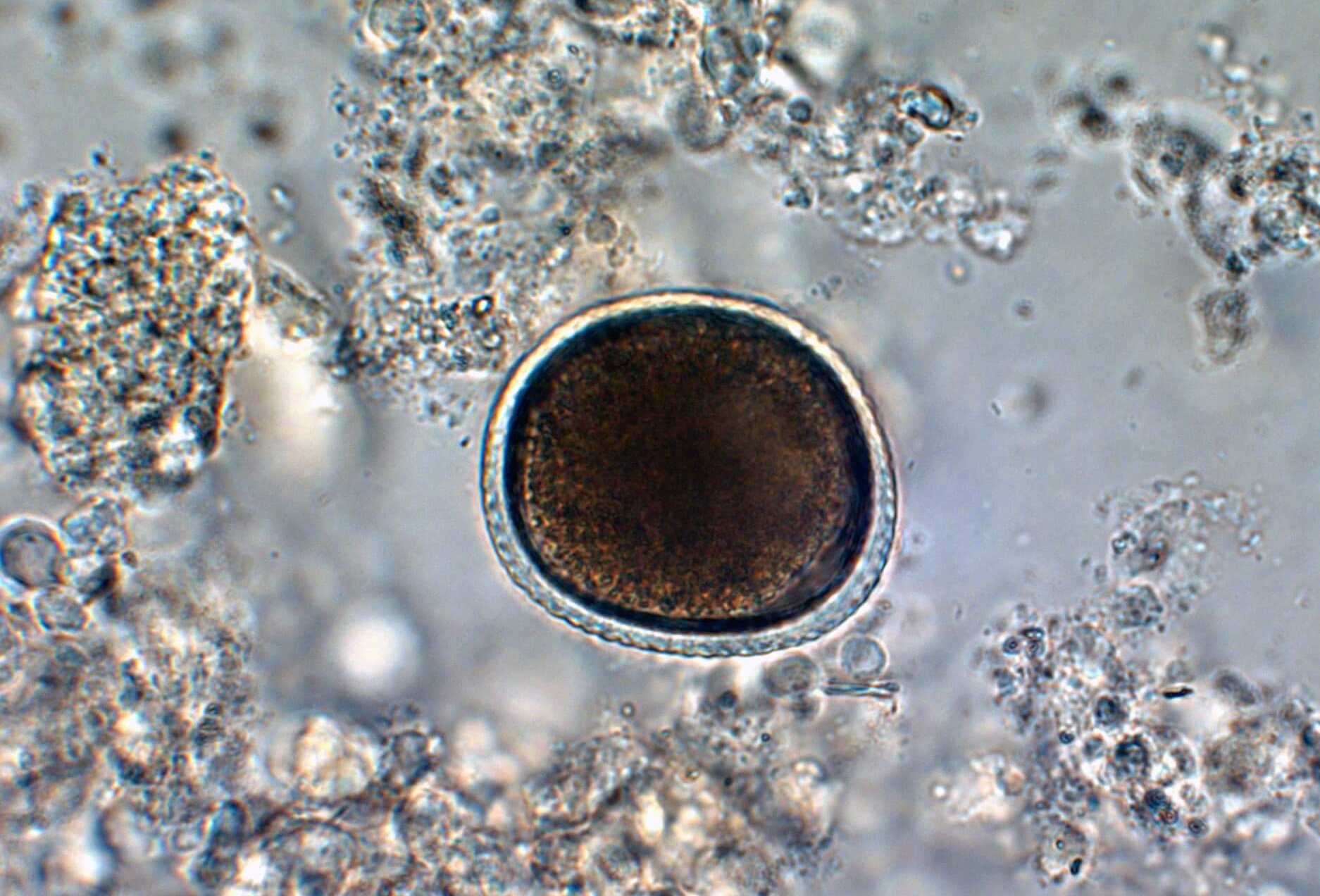 Katzenspulwurm Toxocara cati unter dem Mikroskop
