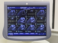 Interne Kleintier BER 0897 150114 Kopie  Monitor beim Herzultraschall