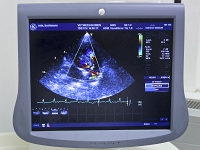 Interne Kleintier BER 0936 150114 Kopie 2  Monitor beim Herzultraschall